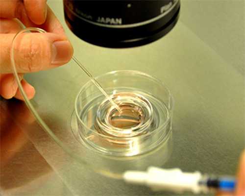 试管促排卵过程解析与珠海妇幼成功率探讨