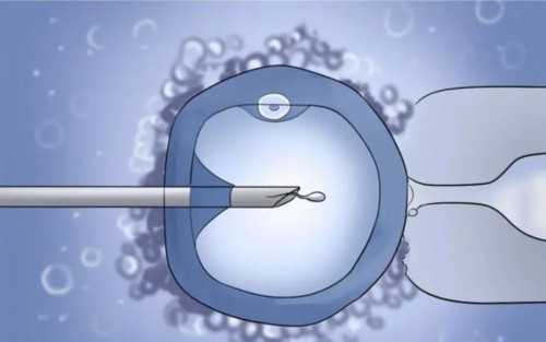 山东与杭州顶尖试管婴儿医院排名及费用解析