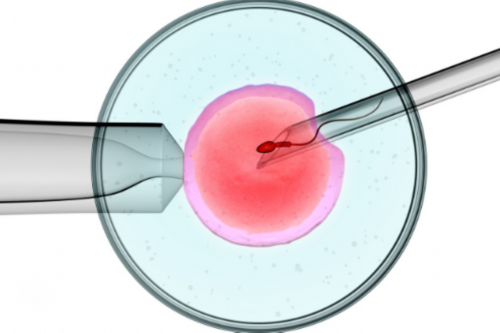 南京试管婴儿双胞胎成功率与风险解析，助孕选择指南
