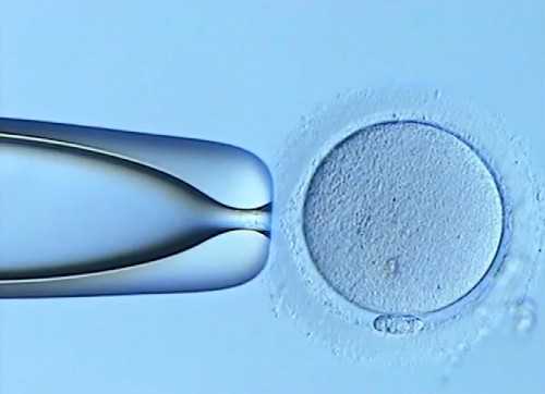 供卵试管流程详解与生男孩可行性分析