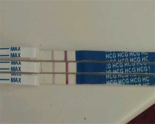 2026年试管婴儿费用解析及技术选择指南