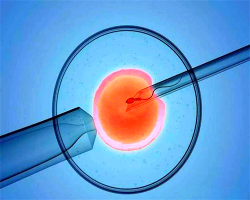 南京试管助孕肝素注射与方案选择指南