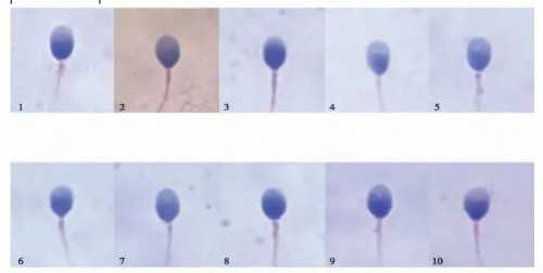 供卵代生费用与三代试管助孕成本详解