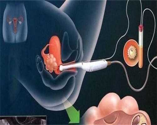 南京三代试管婴儿医院排名与助孕选择指南