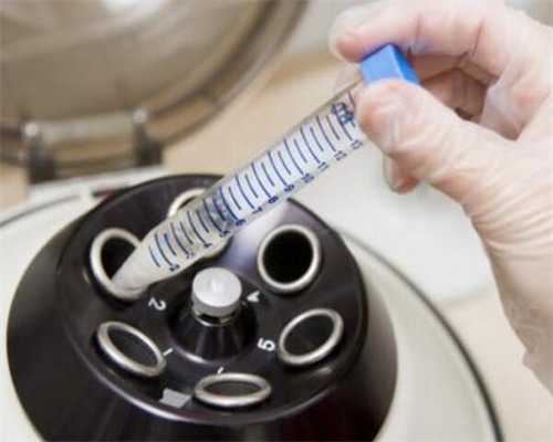 南京试管助孕费用与医院选择指南